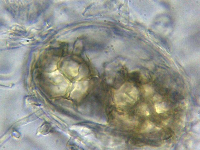 Tuber aestivum dalla fotografia alla microscopia